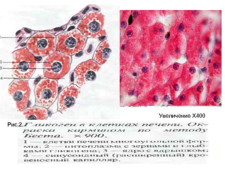 Митохондрии в клетках печени. Клетки печени аксолотля гистология. Клетки Лейдига кожи аксолотля. Секреторные гранулы в клетках кожи аксолотля. Включения гликогена в печени аксолотля.