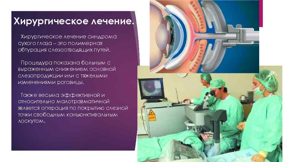Хирургическое лечение синдрома сухого глаза – это полимерная обтурация слезоотводящих путей. Процедура показана больным