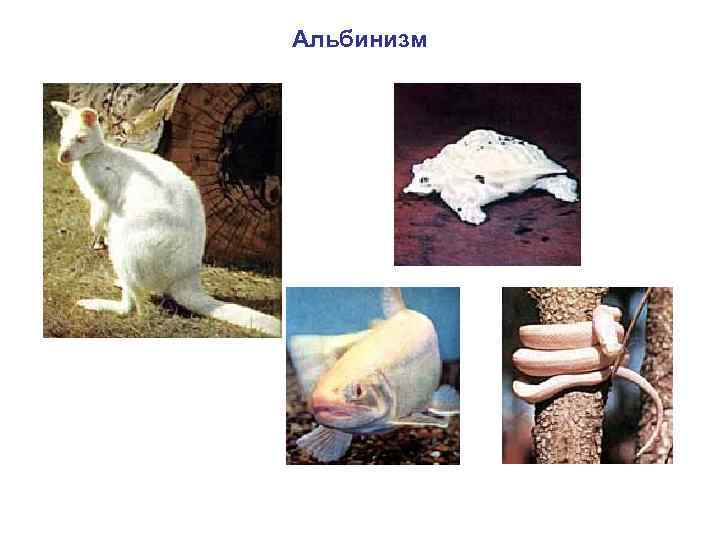 Альбинизм 