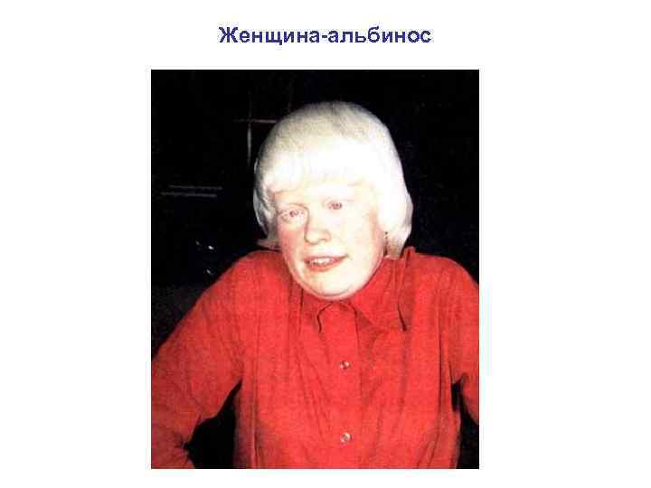 Женщина-альбинос 