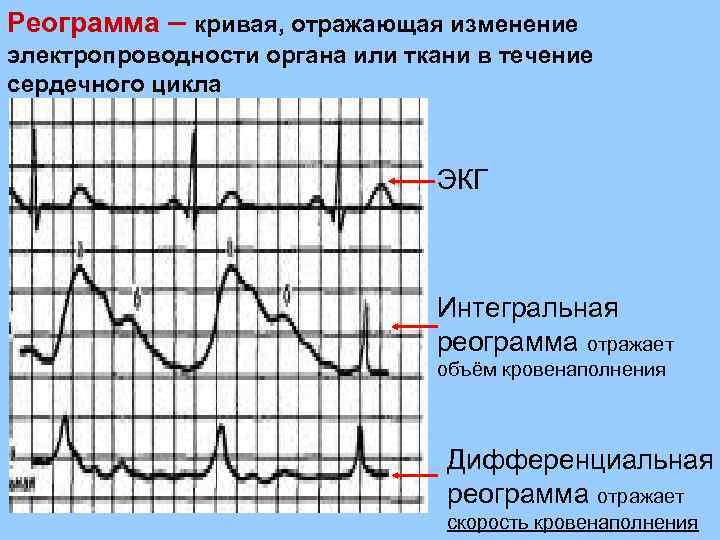 Реограмма – кривая, отражающая изменение электропроводности органа или ткани в течение сердечного цикла ЭКГ