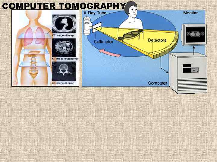 COMPUTER TOMOGRAPHY 