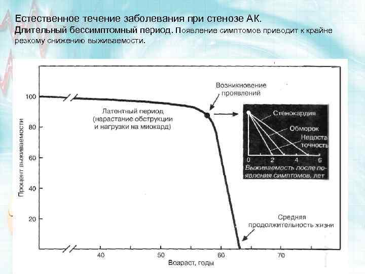 Естественное течение заболевания при стенозе АК. Длительный бессимптомный период. Появление симптомов приводит к крайне