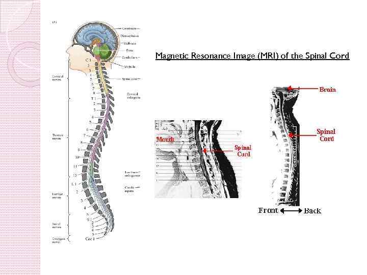 Magnetic Resonance Image (MRI) of the Spinal Cord 