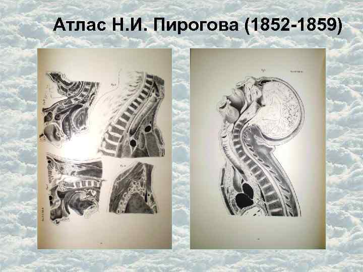 Атлас Н. И. Пирогова (1852 -1859) 