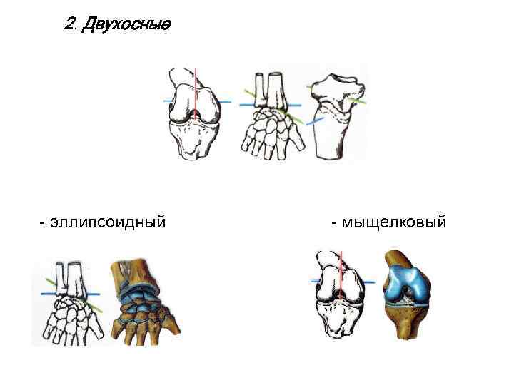 2. Двухосные - эллипсоидный - мыщелковый 