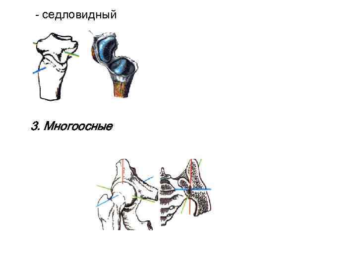 - седловидный 3. Многоосные 