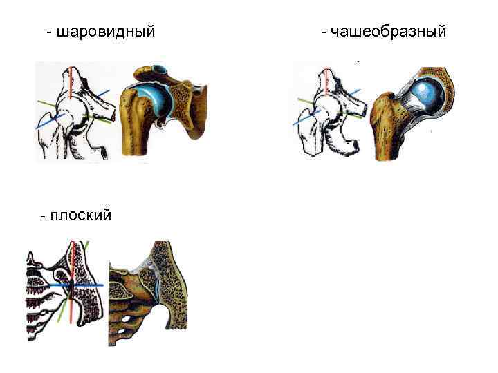 - шаровидный - плоский - чашеобразный 