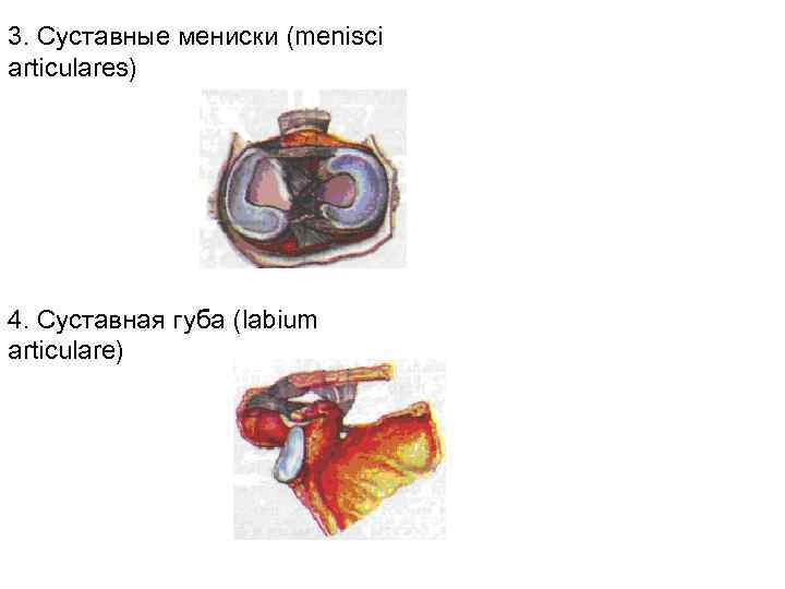 3. Cуставные мениски (menisci articulares) 4. Суставная губа (labium articulare) 