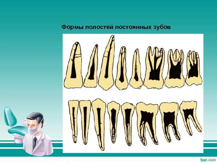 Формы полостей постоянных зубов 