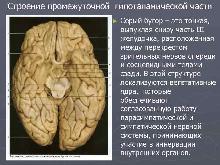 Строение промежуточной гипоталамической части ► Серый бугор – это тонкая, выпуклая снизу часть III