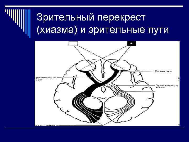 Зрительный перекрест рисунок