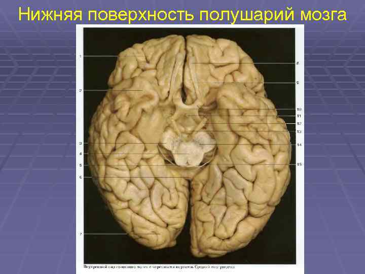 Нижнее полушарие мозга. Базальная поверхность головного мозга анатомия. Поверхности полушарий мозга. Поверхности полушария головного мозга. Поверхности большого мозга.