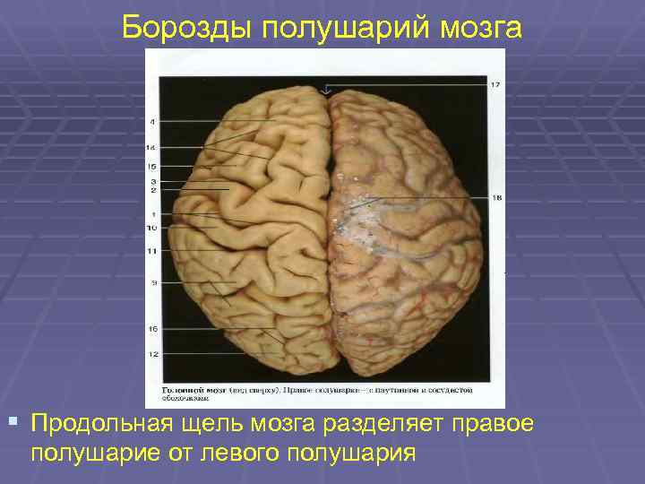 Борозды мозга. Борозды полушарий. Борозды полушарий конечного мозга. Поперечная щель большого мозга. Продольная щель большого мозга.
