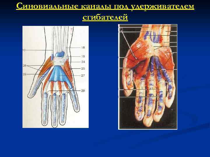 Синовиальные каналы под удерживателем сгибателей 