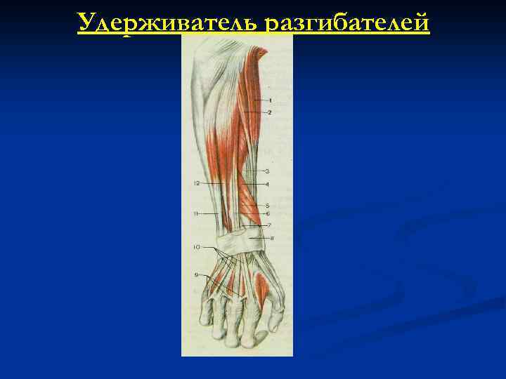 Удерживатель разгибателей 