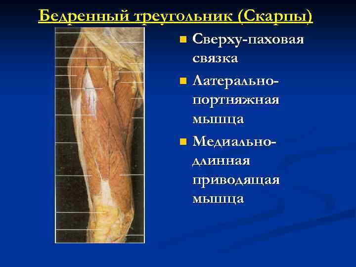 Бедренный треугольник (Скарпы) Сверху-паховая связка n Латеральнопортняжная мышца n Медиальнодлинная приводящая мышца n 