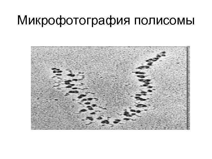 Микрофотография полисомы 