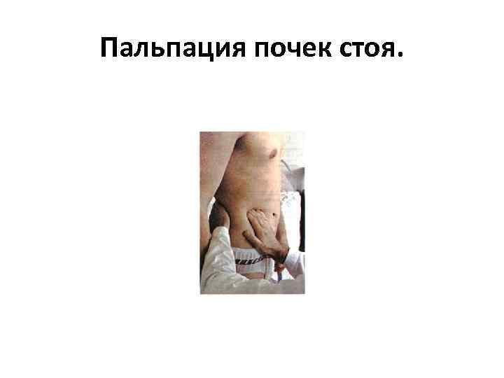 Пальпация почек стоя. 