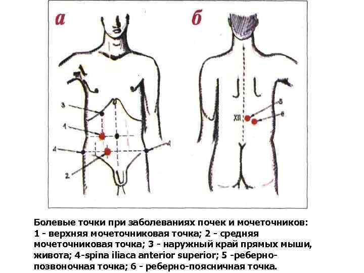 Болевые точки при заболеваниях почек и мочеточников: 1 - верхняя мочеточниковая точка; 2 -