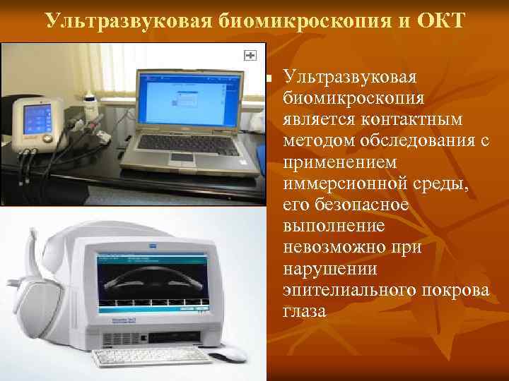 Ультразвуковая биомикроскопия и ОКТ n Ультразвуковая биомикроскопия является контактным методом обследования с применением иммерсионной