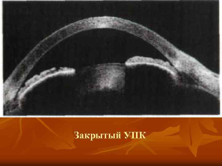 Закрытый УПК 