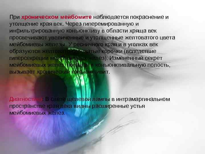 При хроническом мейбомите наблюдается покраснение и утолщение края век. Через гиперемированную и инфильтрированную конъюнктиву