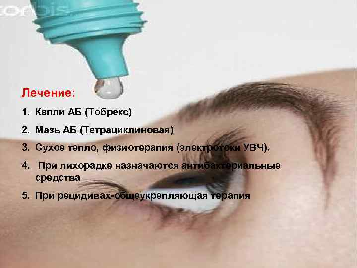 Лечение: 1. Капли АБ (Тобрекс) 2. Мазь АБ (Тетрациклиновая) 3. Сухое тепло, физиотерапия (электротоки