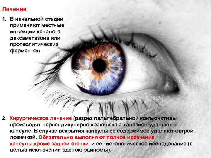 Лечение 1. В начальной стадии применяют местные инъекции кеналога, дексаметазона или протеолитических ферментов 2.