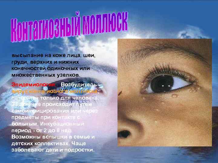 высыпание на коже лица, шеи, груди, верхних и нижних конечностей одиночных или множественных узелков.