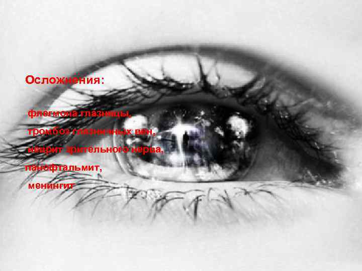 Осложнения: флегмона глазницы, тромбоз глазничных вен, неврит зрительного нерва, панофтальмит, менингит 