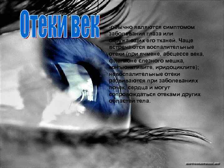 -обычно являются симптомом заболевания глаза или окружающих его тканей. Чаще встречаются воспалительные отеки (при