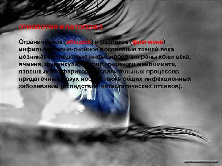 ЭТИОЛОГИЯ И ПАТОГЕНЕЗ Ограниченное (абсцесс) и разлитое (флегмона) инфильтративно-гнойное воспаление тканей века возникает вследствие