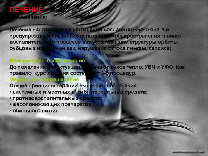 ЛЕЧЕНИЕ Цели лечения: Лечение направлено на устранение воспалительного очага и предупреждение развития осложнений (распространения