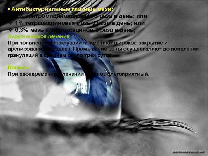  • Антибактериальные глазные мази: ❖ 1% эритромициновая мазь 3 раза в день; или