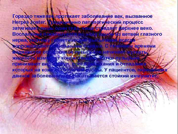 Гораздо тяжелее протекает заболевание век, вызванное Herpes zoster. Традиционно патологический процесс затягивает лишь один