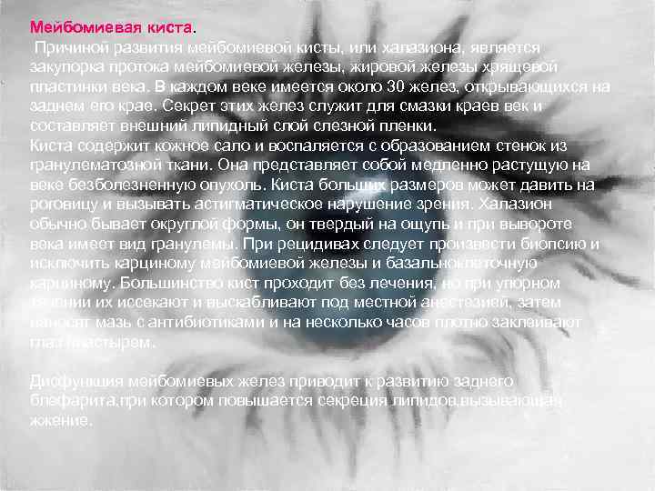 Мейбомиевая киста. Причиной развития мейбомиевой кисты, или халазиона, является закупорка протока мейбомиевой железы, жировой