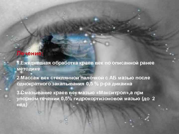 Лечение: 1. Ежедневная обработка краев век по описанной ранее методике 2. Массаж век стеклянной