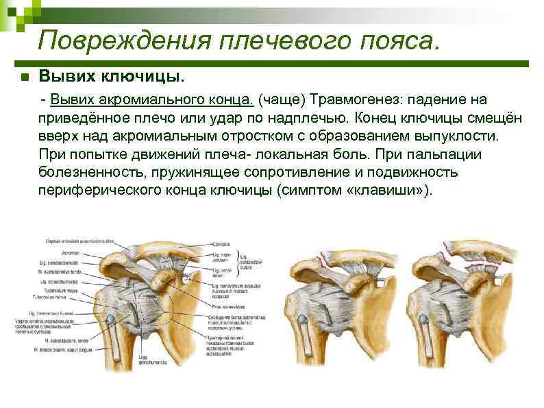 Ушиб плечевого сустава карта вызова