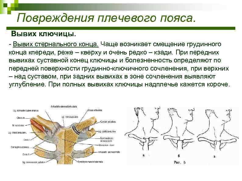 Вывих плеча карта смп