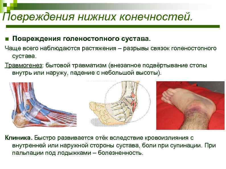 Травмы опорно двигательного аппарата