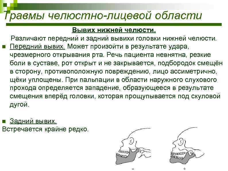 Травмы челюстно-лицевой области n Вывих нижней челюсти. Различают передний и задний вывихи головки нижней
