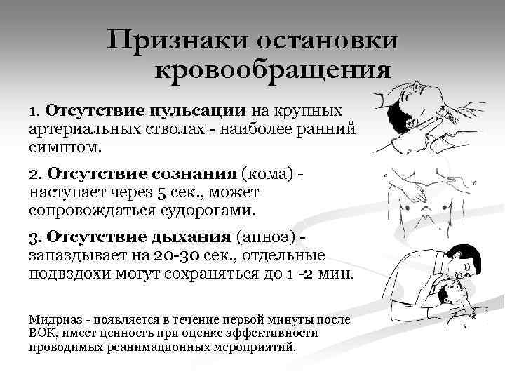 Признаки остановки кровообращения 1. Отсутствие пульсации на крупных артериальных стволах - наиболее ранний симптом.