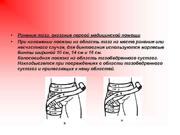  • • Ранения таза, оказание первой медицинской помощи При наложении повязки на область