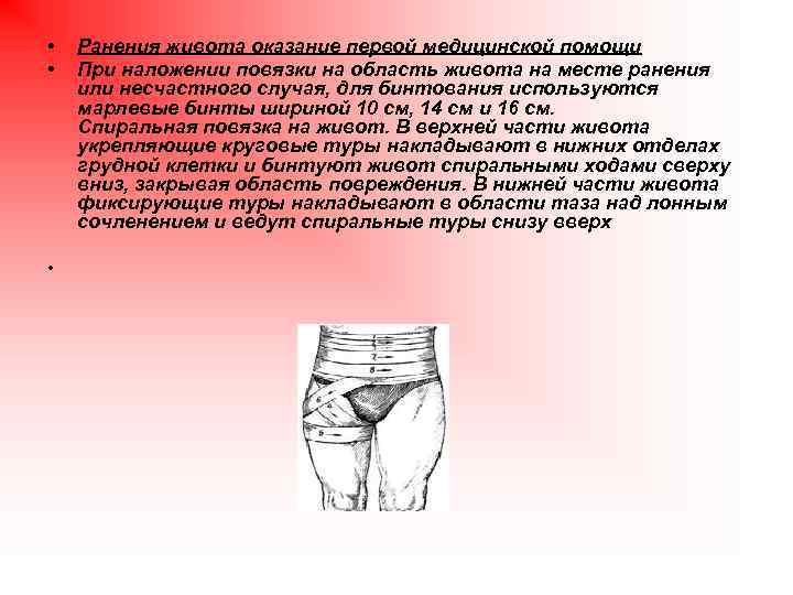  • • Ранения живота оказание первой медицинской помощи При наложении повязки на область