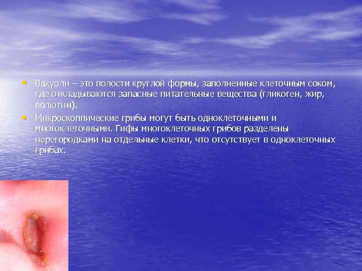  • Вакуоли – это полости круглой формы, заполненные клеточным соком, • где откладываются