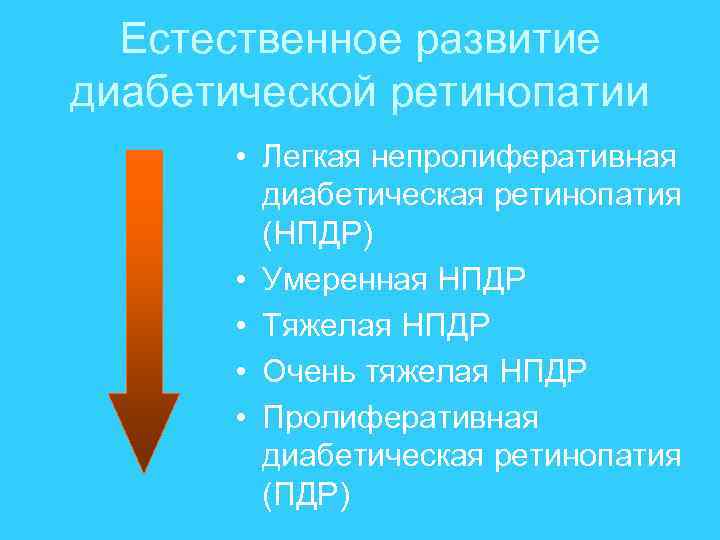 Естественное развитие диабетической ретинопатии • Легкая непролиферативная диабетическая ретинопатия (НПДР) • Умеренная НПДР •