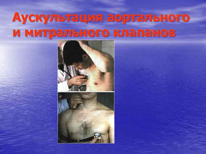 Аускультация аортального и митрального клапанов 