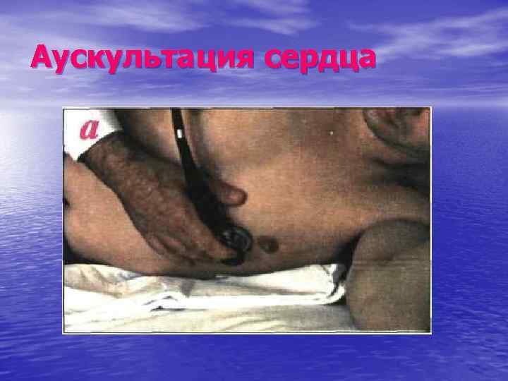 Аускультация сердца 