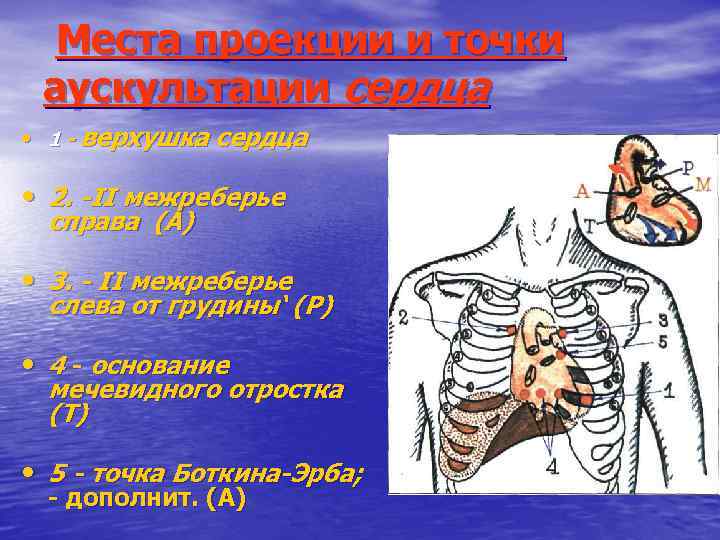 Машинный шум при аускультации